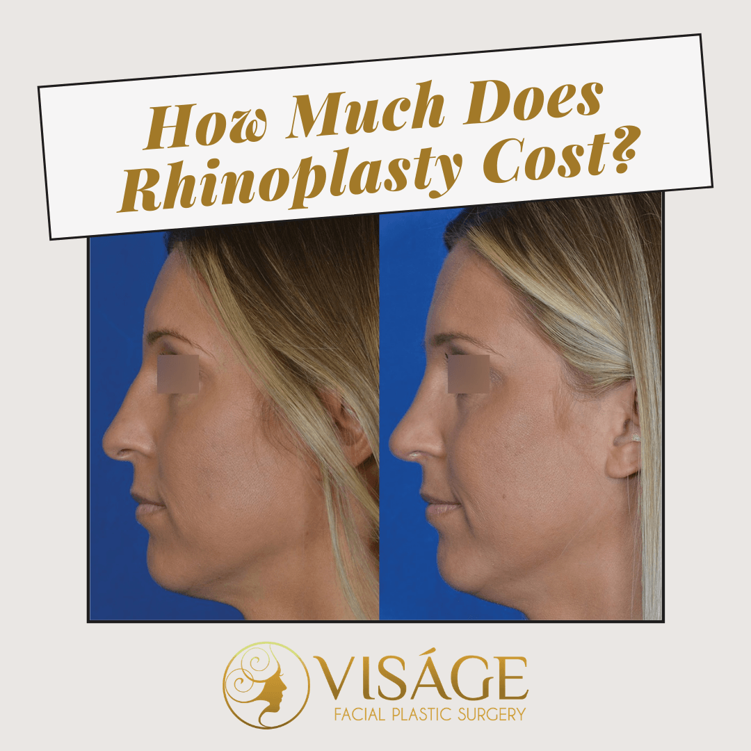 How Much Does Rhinoplasty Cost